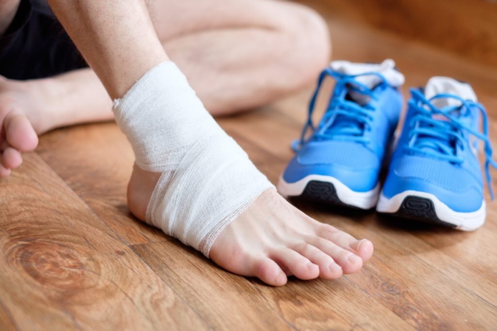 Types of Ankle Sprains and How to Treat Them