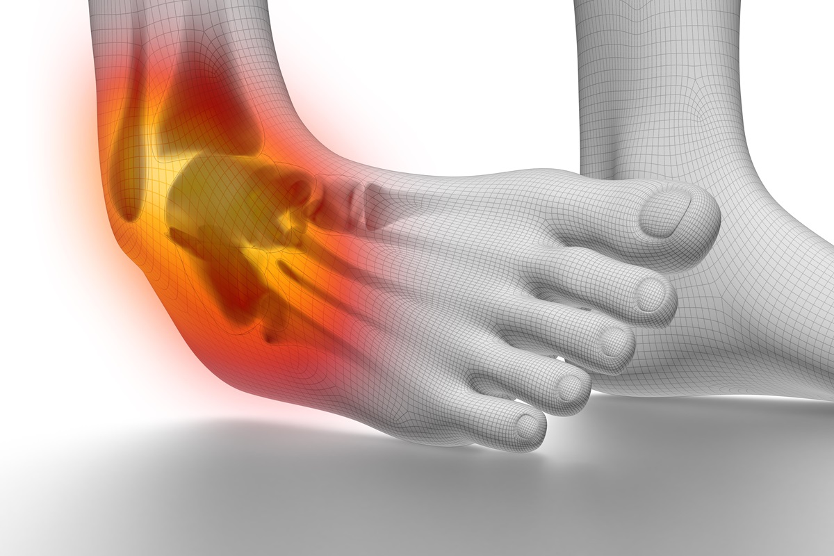 Types of Ankle Sprains and How to Treat Them