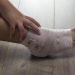 What You Need to Know About Foot Fractures and Stress Injuries