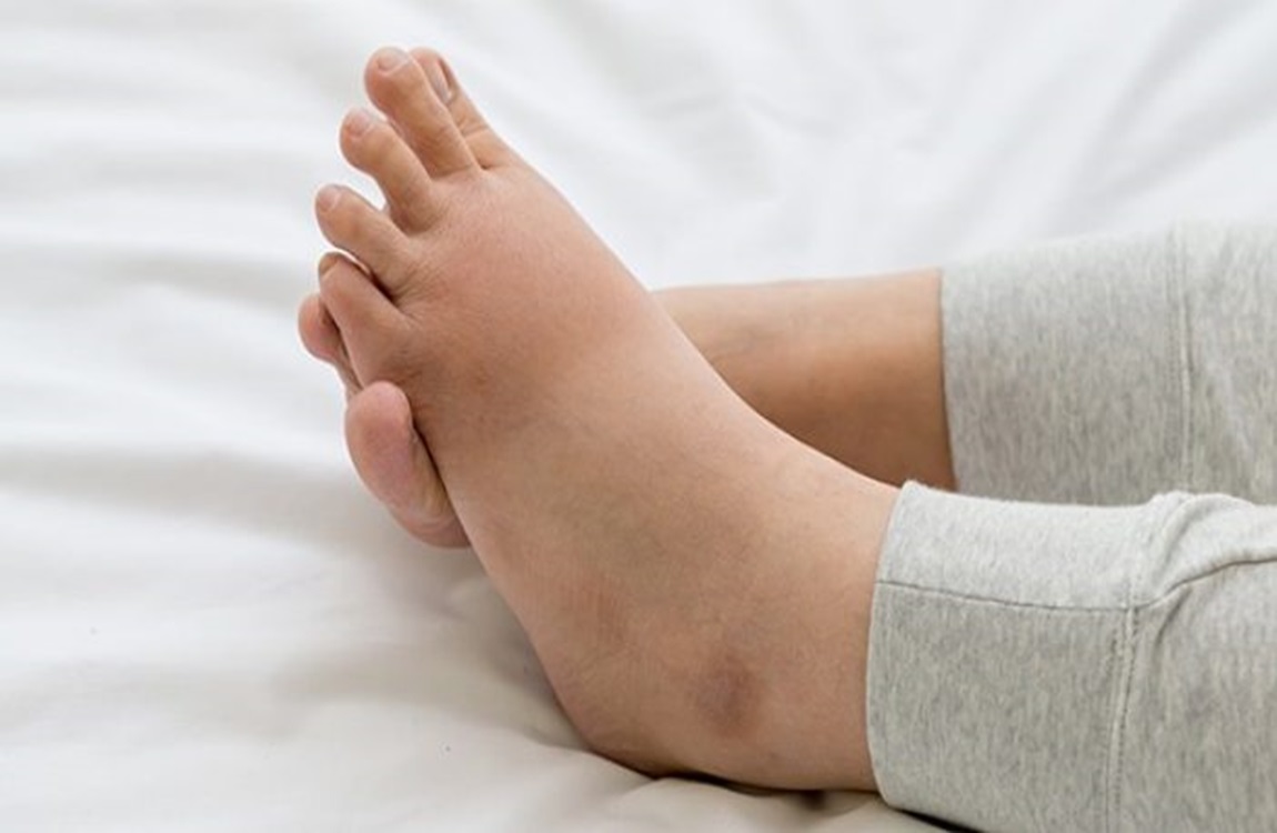 When Pain, Swelling, or Bruising Point to a Bigger Problem