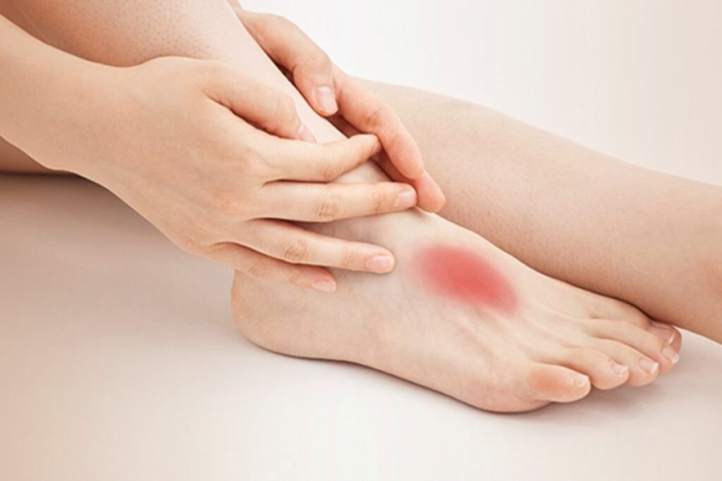 Arthritis in Top of Foot – Causes, Diagnosis & Treatment