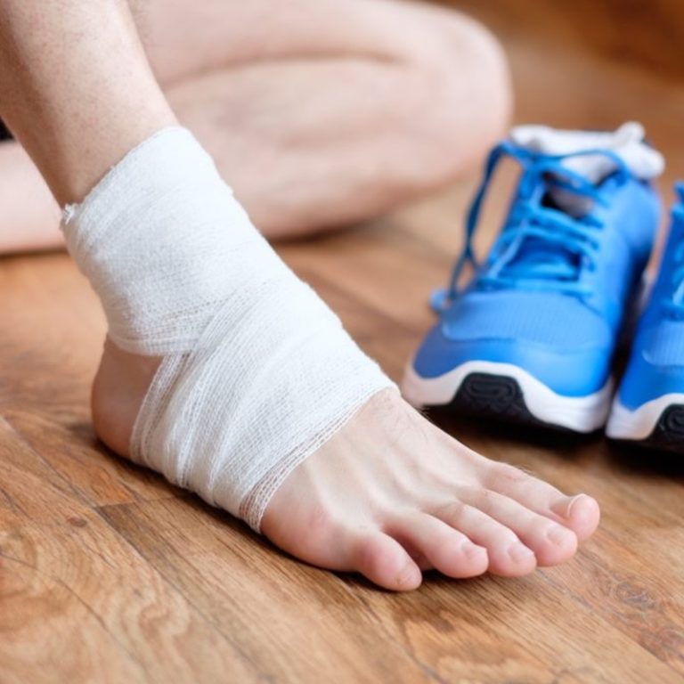 Types of Ankle Sprains and How to Treat Them