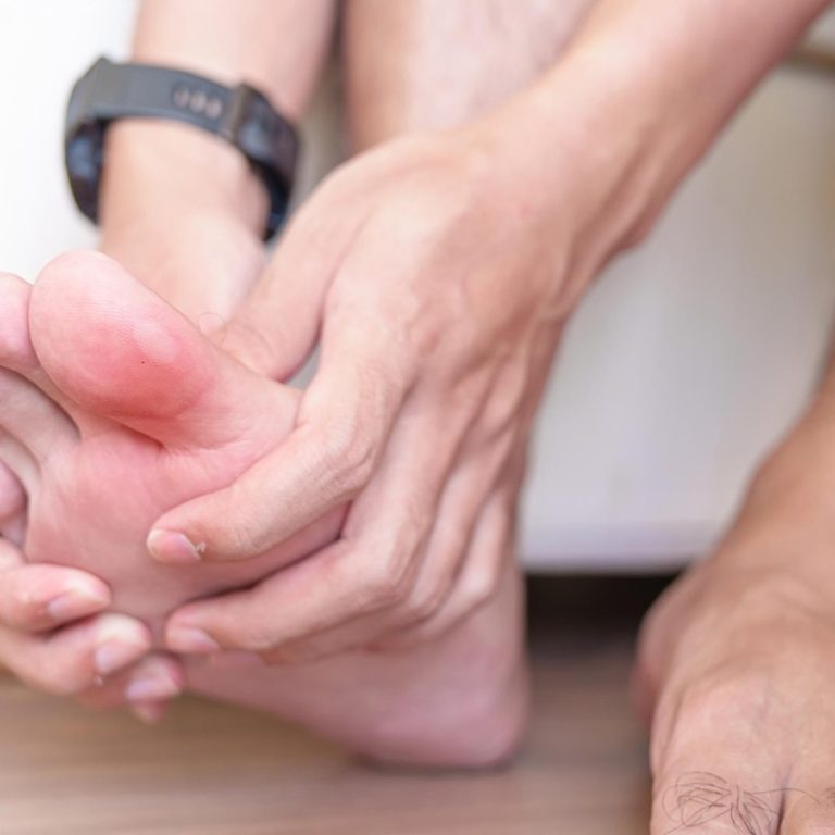 What’s the Big Deal with the Big Toe